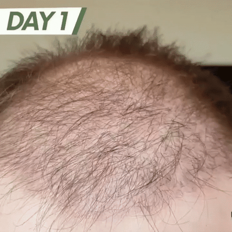 Tónico Para Crecimiento Capilar 🧔🤩 – Chile Necesidades