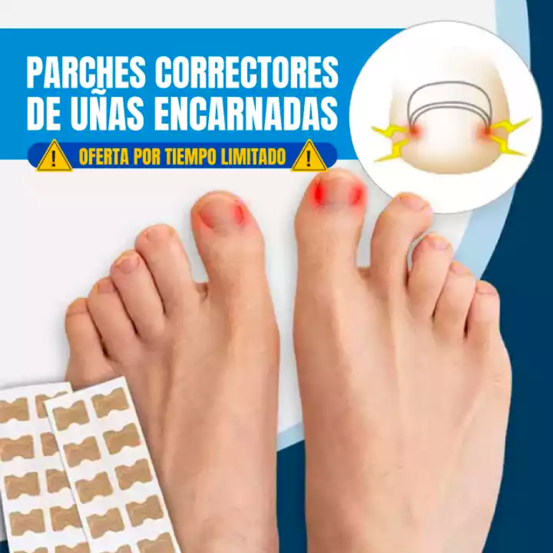 PARCHES CORRECTORES DE UÑAS - 🔥 OFERTA DEL DÍA 🔥