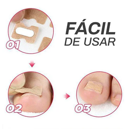 PARCHES CORRECTORES DE UÑAS - 🔥 OFERTA DEL DÍA 🔥